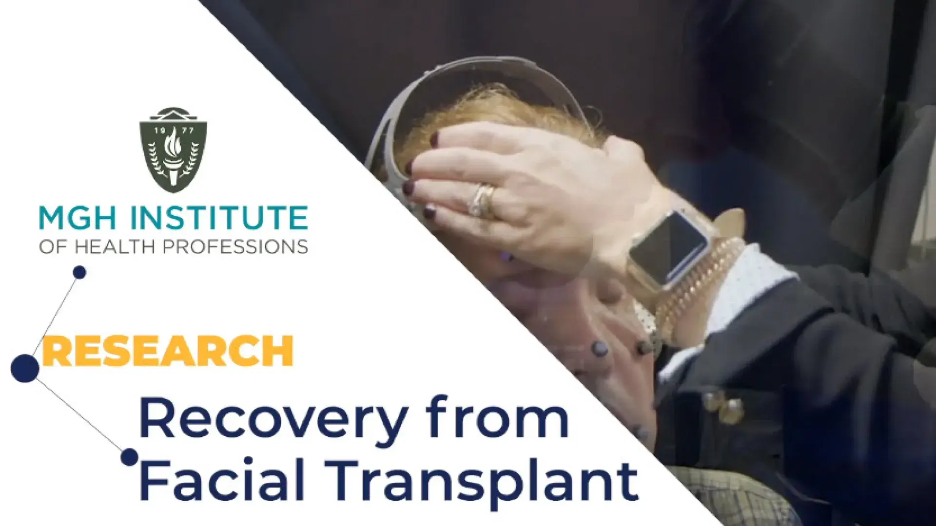 Title Card showing the Video Title "Recovery from Facial Transplant" along with the MGH IHP Logo and a partial image of a man with his eyes closed having sensors placed on his by a woman's hand wearing a large watch and jewelry