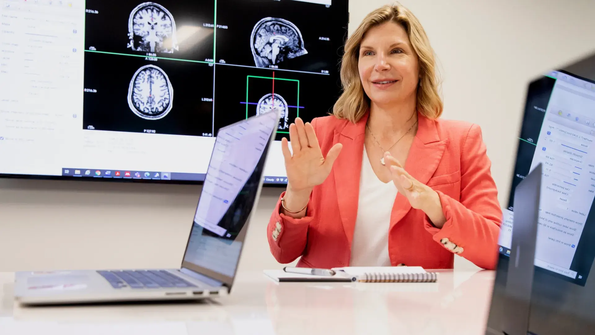 Woman sitting at a table with a brain scan image behind her